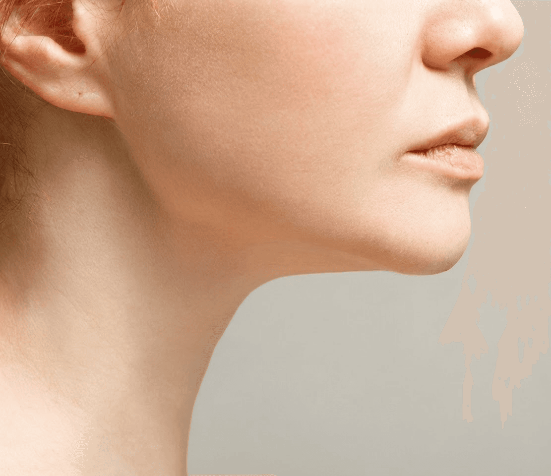 Double Chin Removal at A.Maks Aesthetics Med Spa