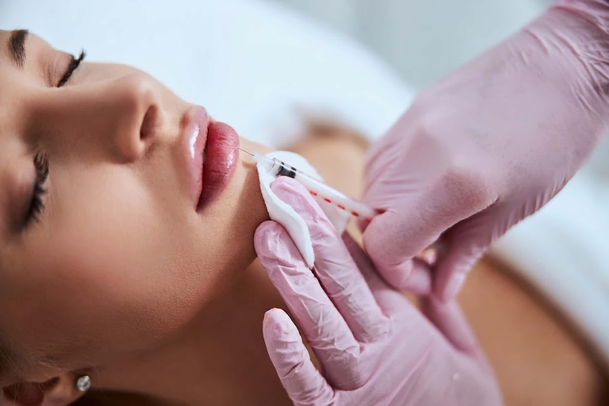 Lip Fillers at A.Maks Aesthetics Med Spa