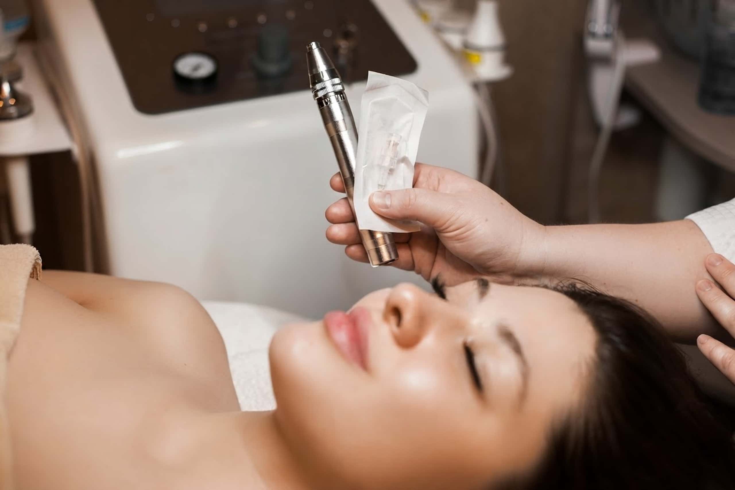 RF Microneedling at A.Maks Aesthetics Med Spa