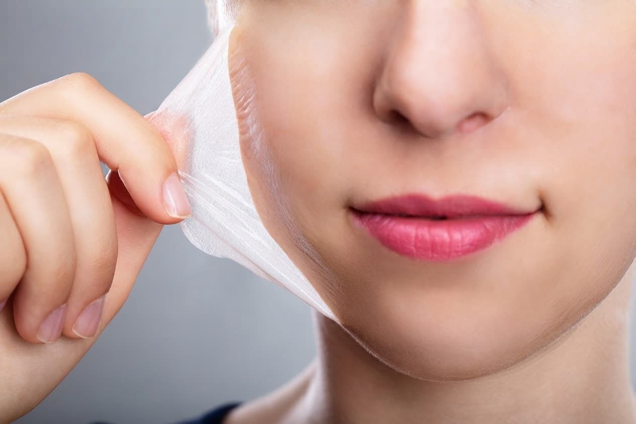 VI Peel at A.Maks Aesthetics Med Spa